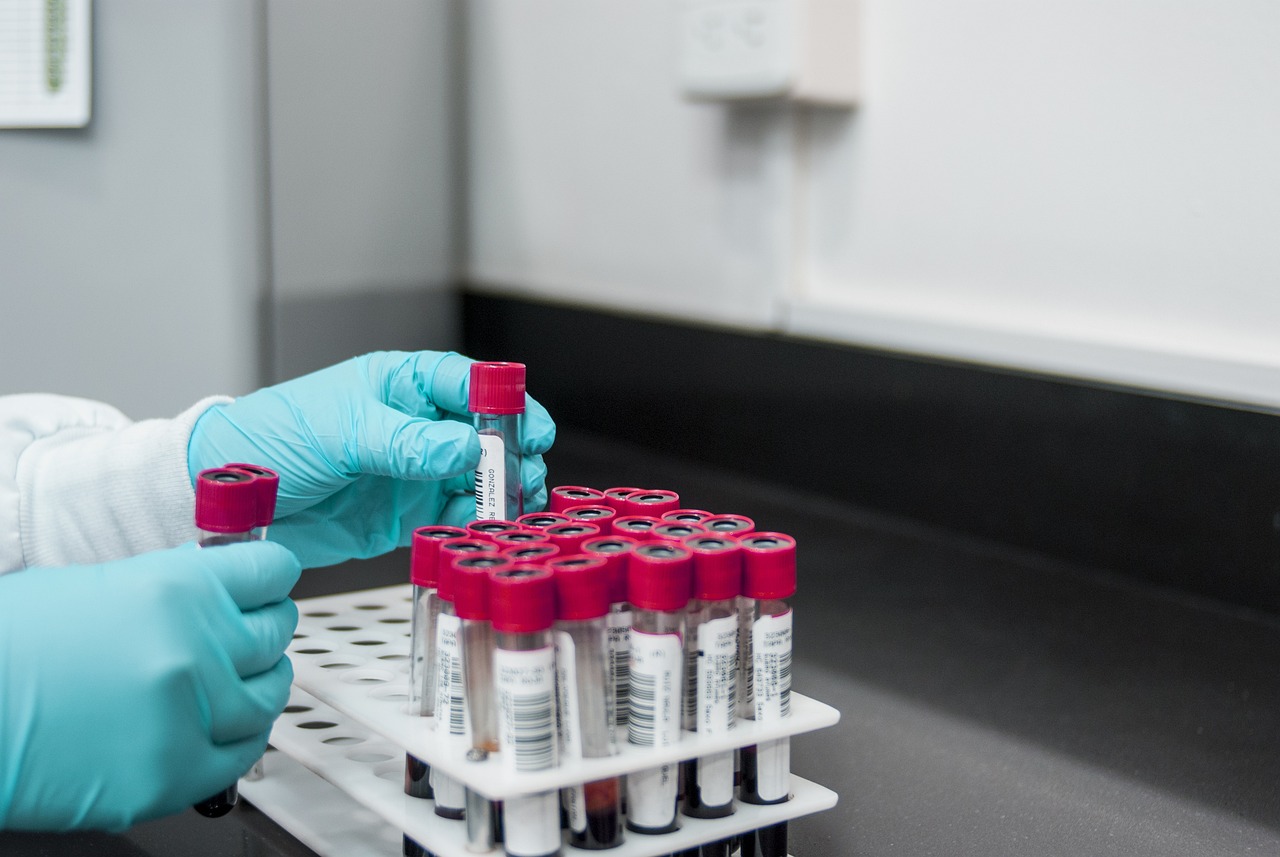 Labs & Diagnostics